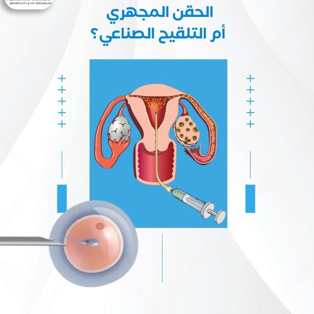 اطفال انابيب ولا حقن صناعي